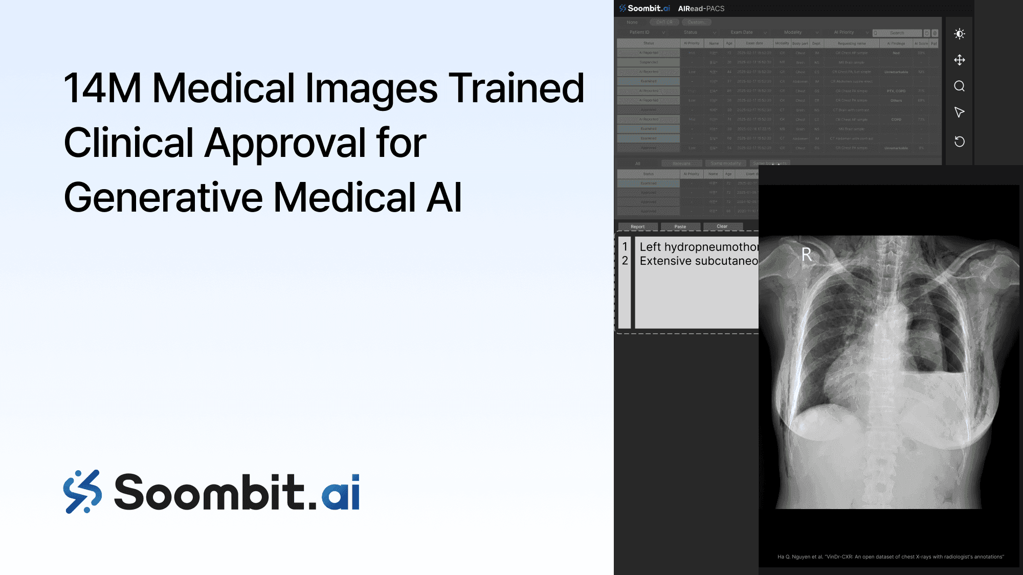  Soombit AI Trains on 14 Million Medical Images, Pursuing Korea’s First Regulatory Approval for a Generative AI Medical Device